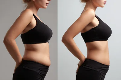 Before And After Weight Loss Comparison