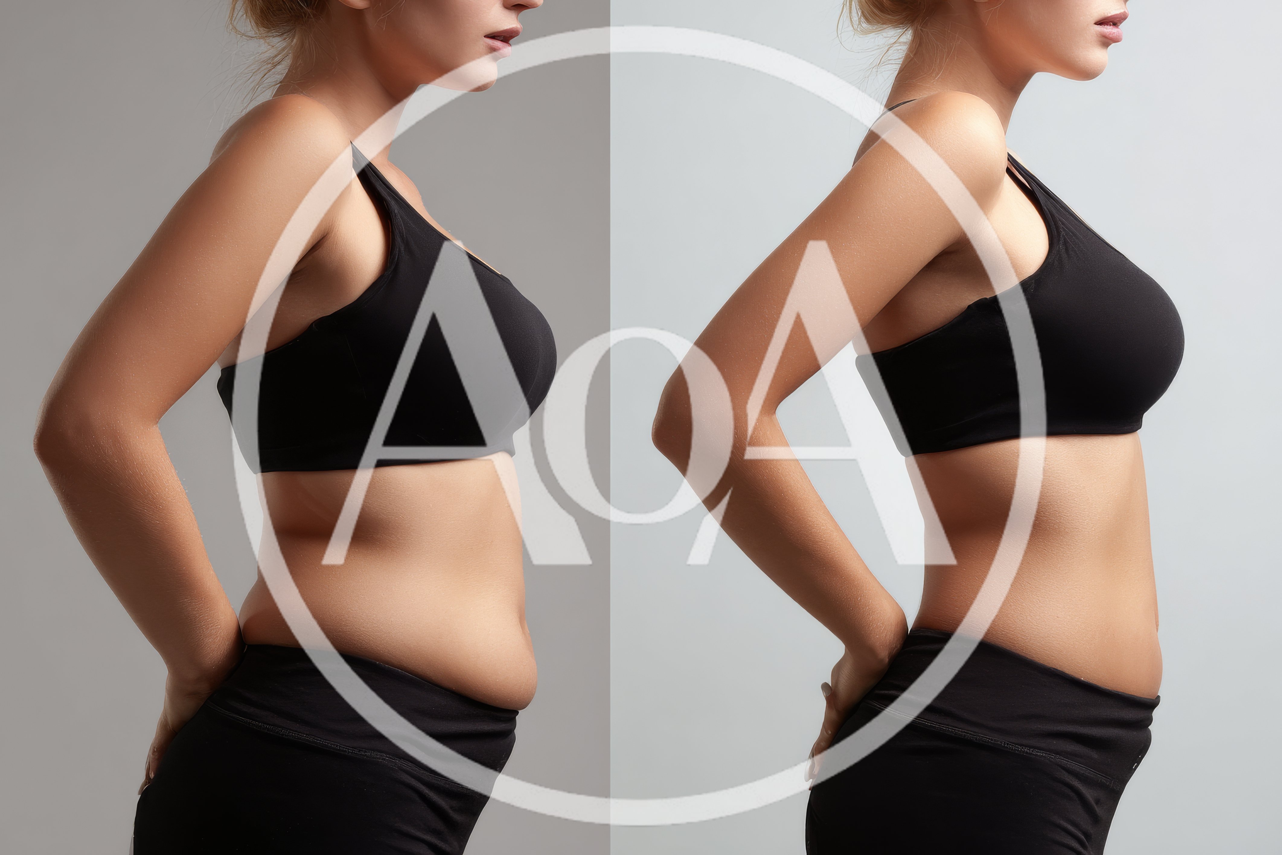 Before And After Weight Loss Comparison