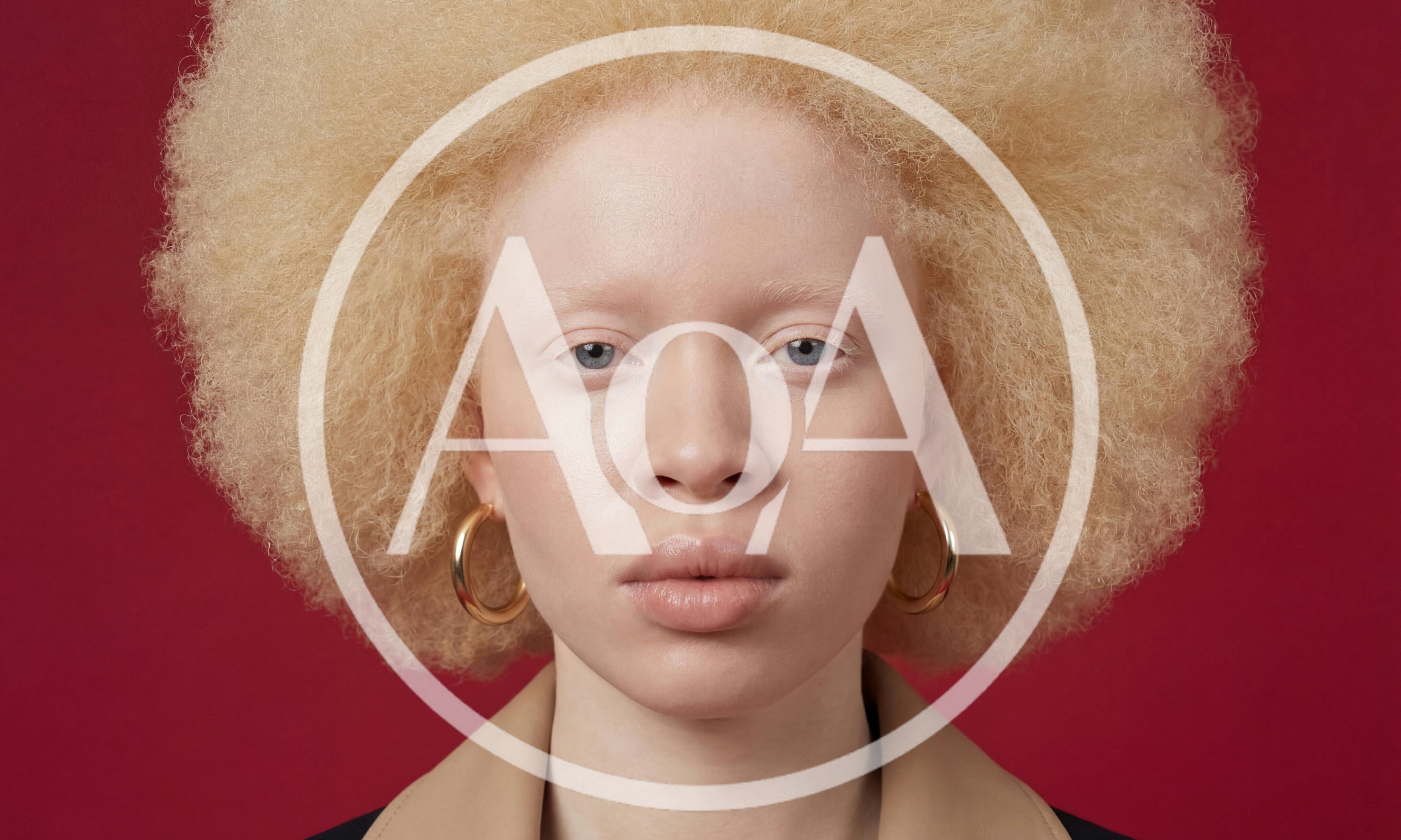 Portrait Of A Young Woman With Albinism