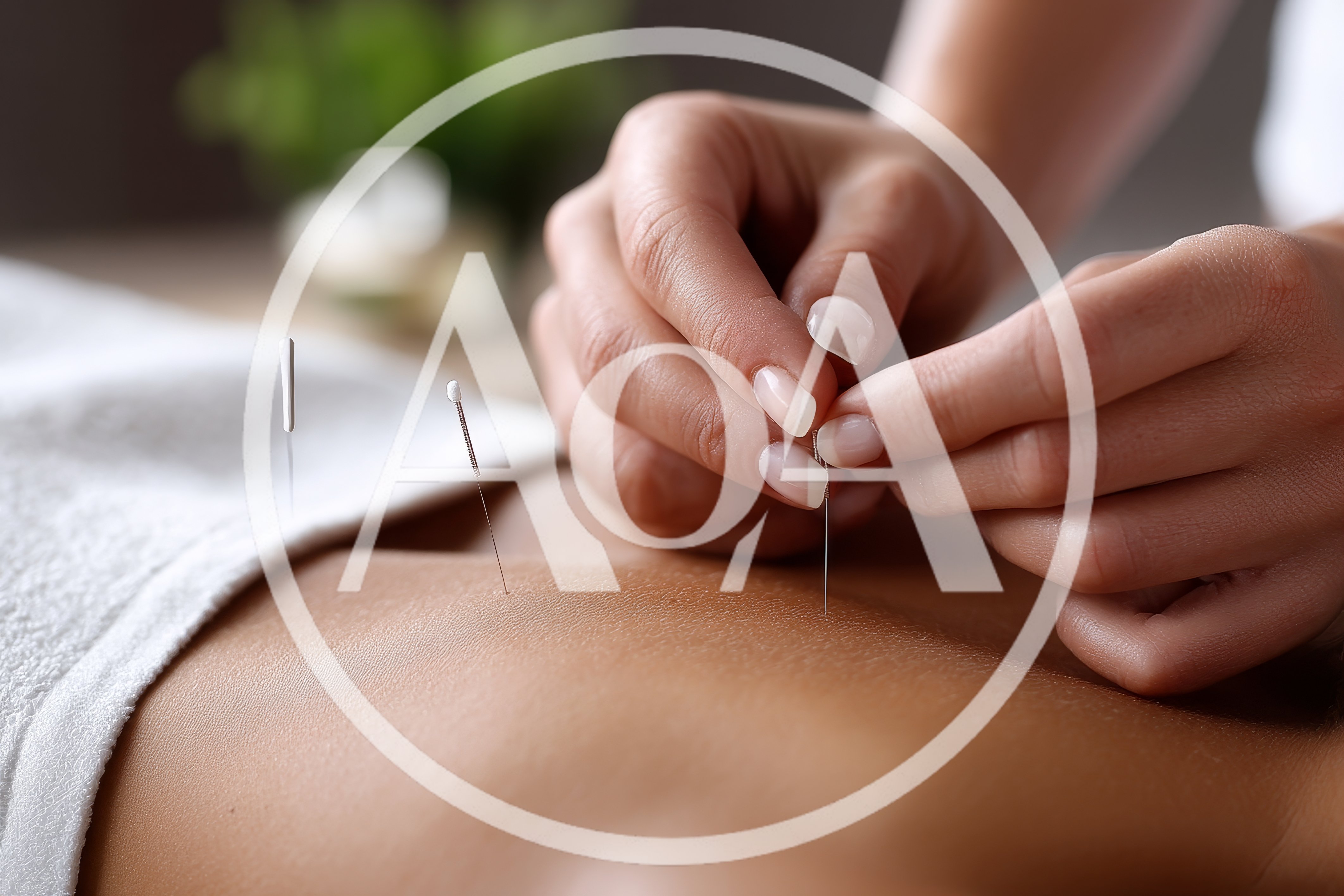 Acupuncturist Performing Treatment On A Patient Back