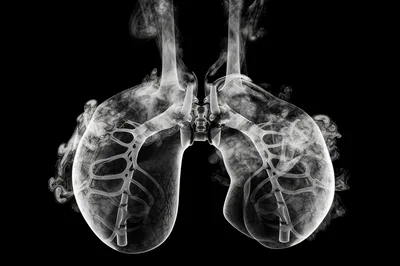 Abstract Artistic Representation Of Human Lungs With Smoke