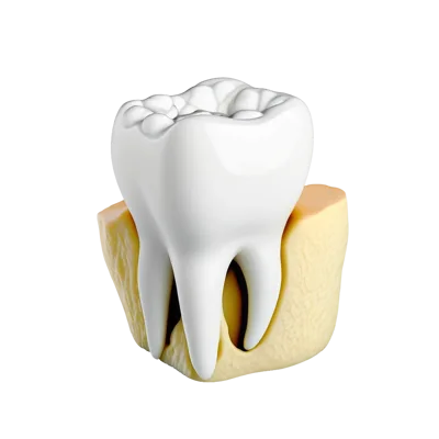 3D Render Of A Human Molar Tooth In Jawbone