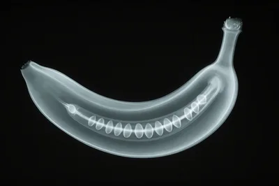 X-Ray Scan Of A Single Ripe Banana