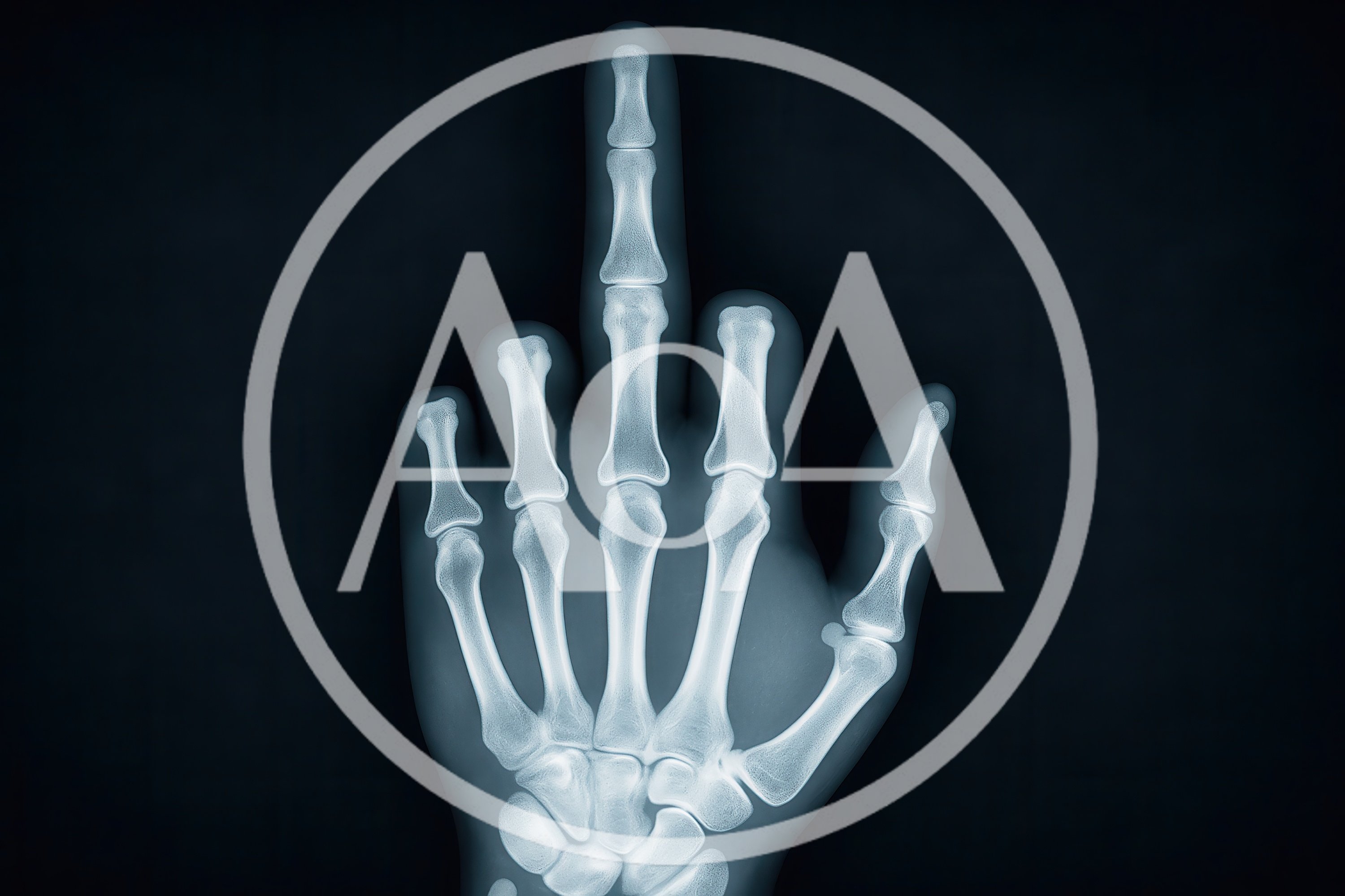 X-Ray Image Of A Hand Giving The Middle Finger