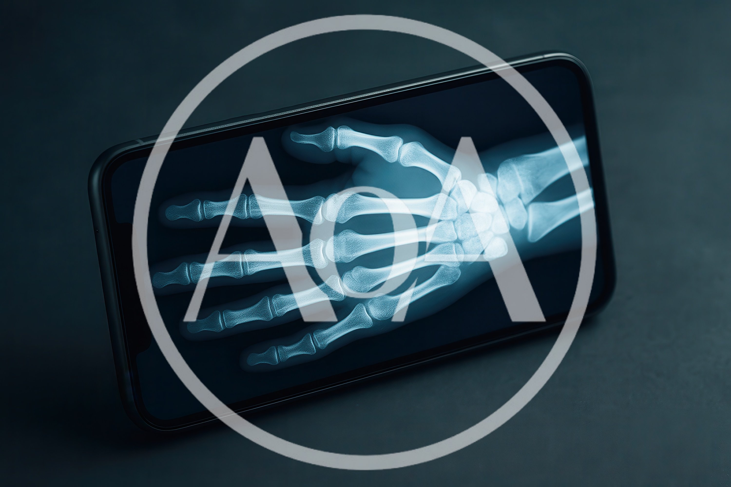 Smartphone Displaying An X-Ray Of A Human Hand