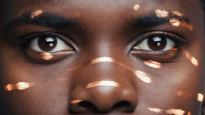 Close Up Portrait Of A Person With Vitiligo