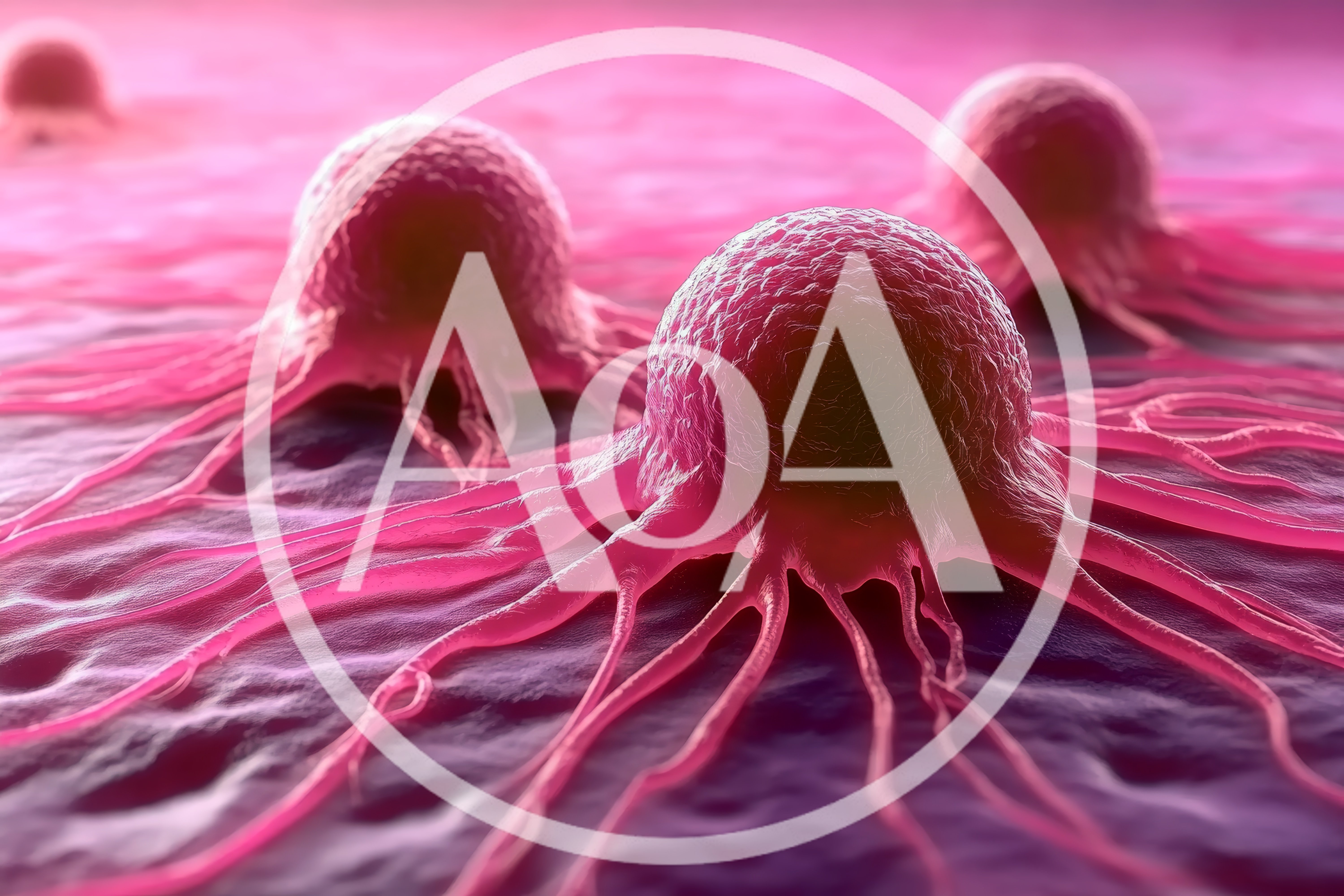 3D Render Of Cancer Cells Spreading