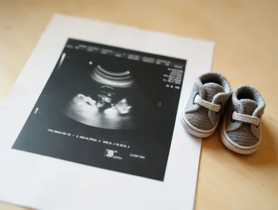 Ultrasound Scan With Baby Shoes On Wooden Table