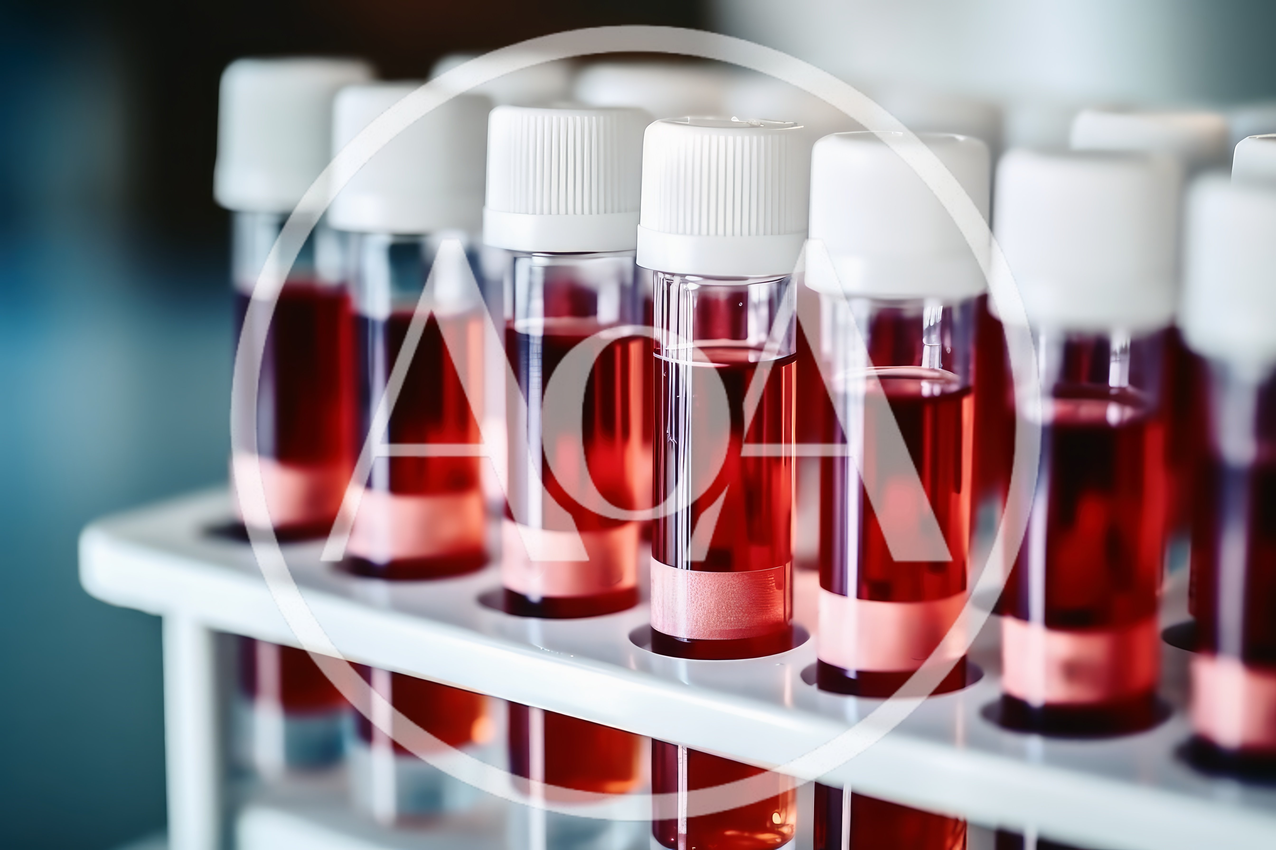 Laboratory Test Tubes Filled With Red Blood Samples