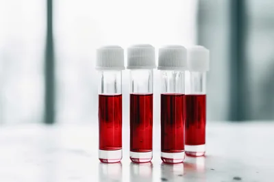 Four Glass Vials Filled With Red Liquid Samples