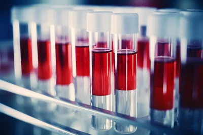 Laboratory Test Tubes Filled With Red Blood Samples
