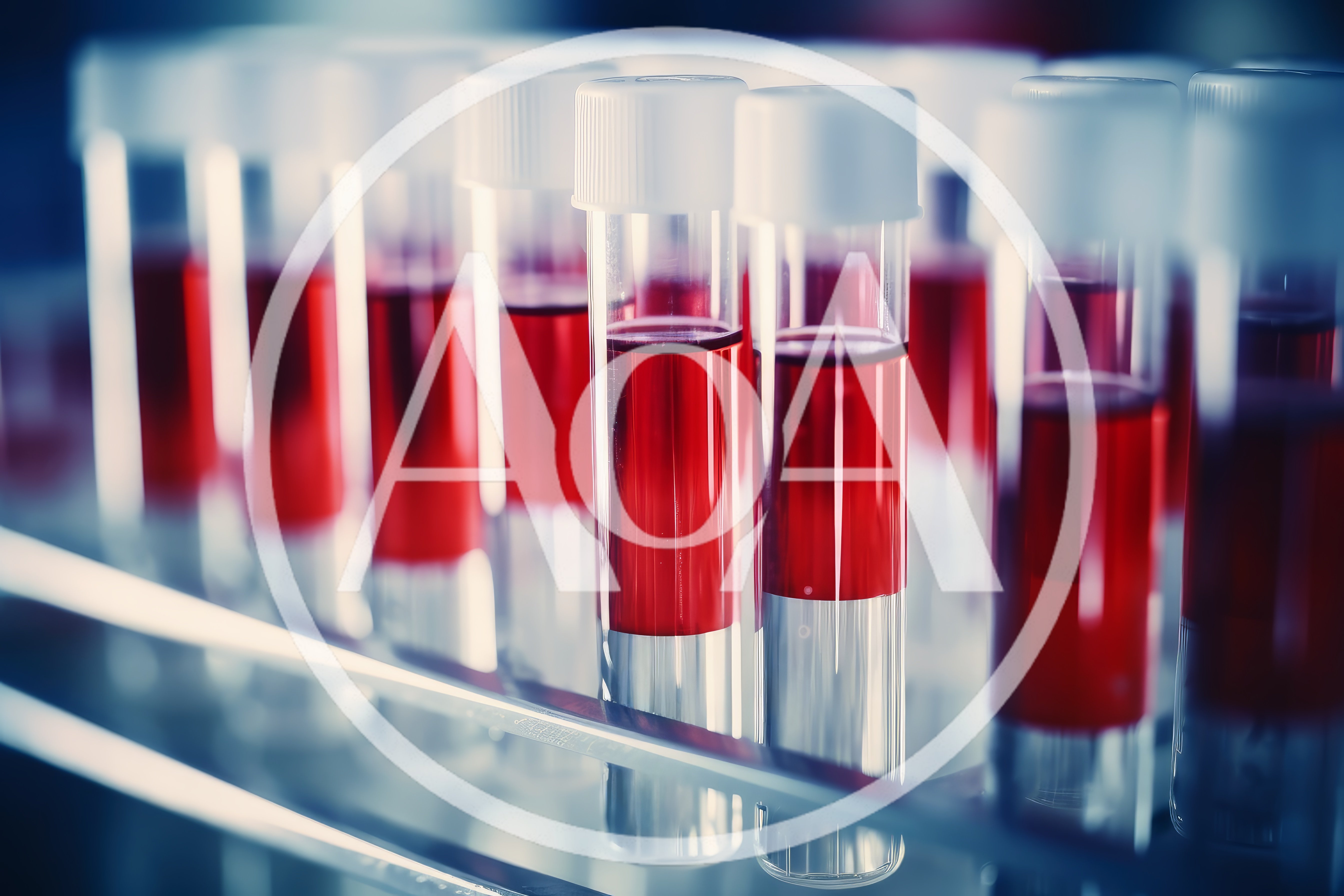 Laboratory Test Tubes Filled With Red Blood Samples