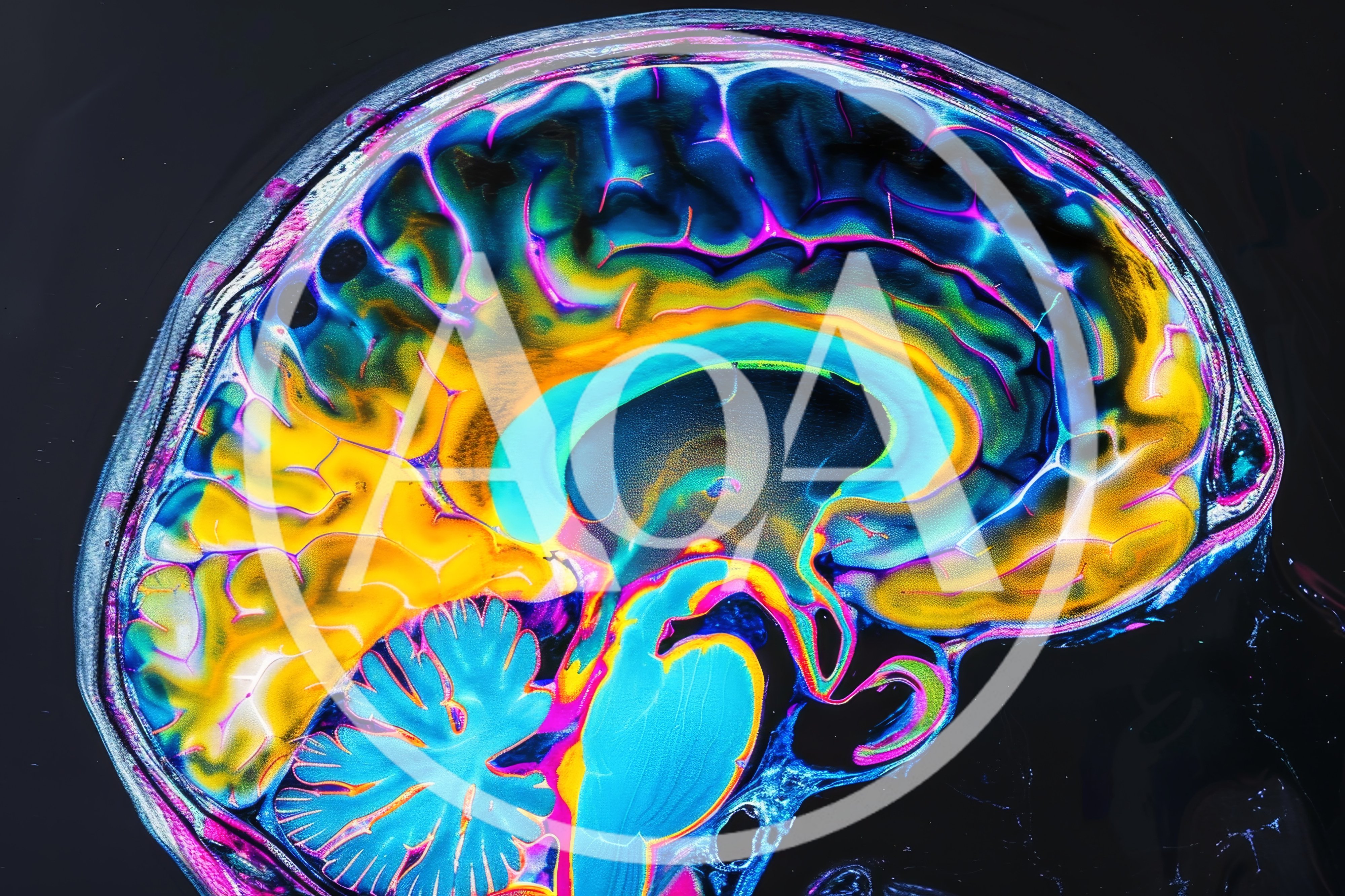 Vibrant False Color Sagittal Brain MRI Scan