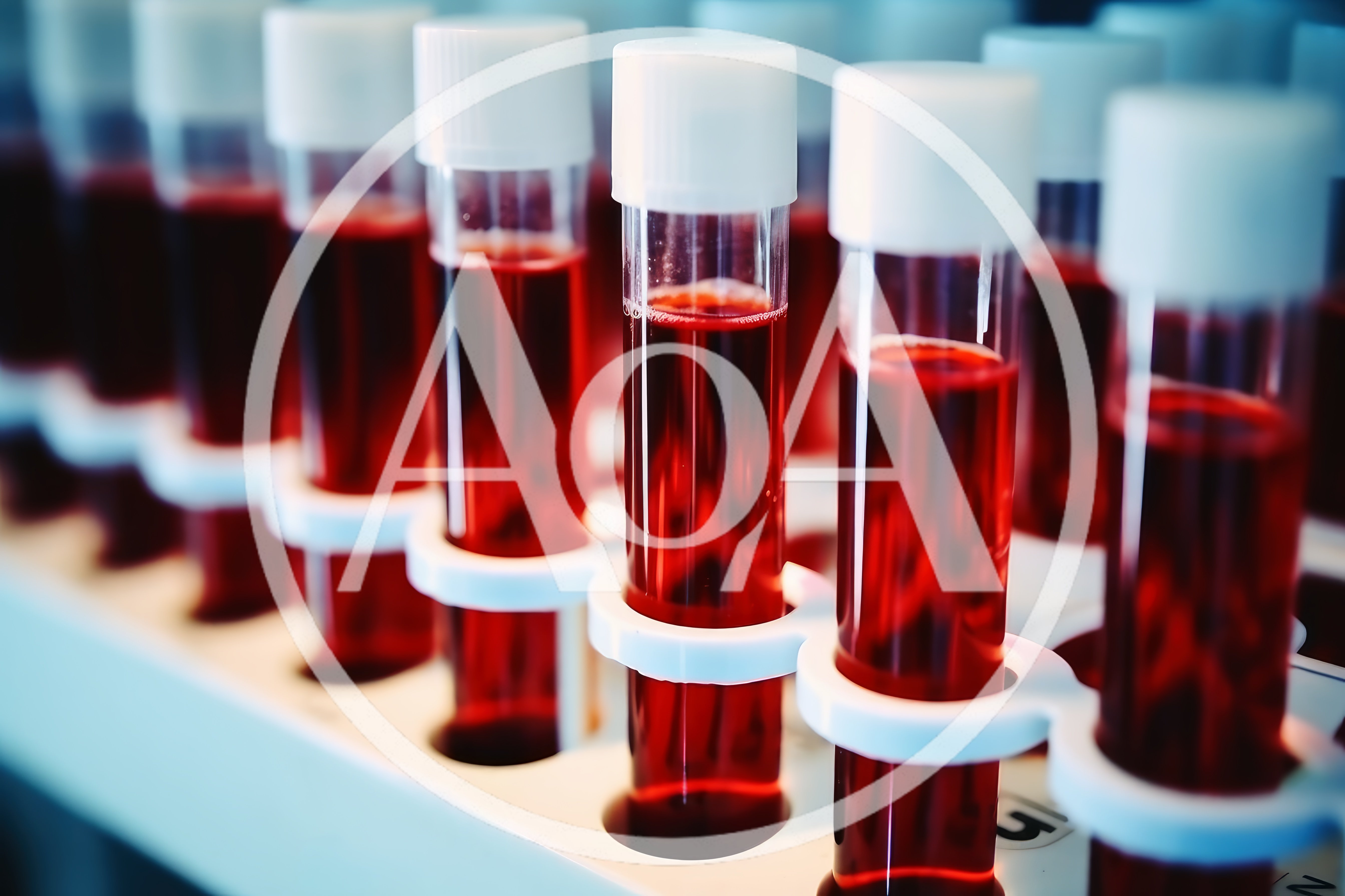 Laboratory Test Tubes Filled With Blood Samples