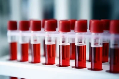 Medical Blood Test Tubes In Laboratory Rack