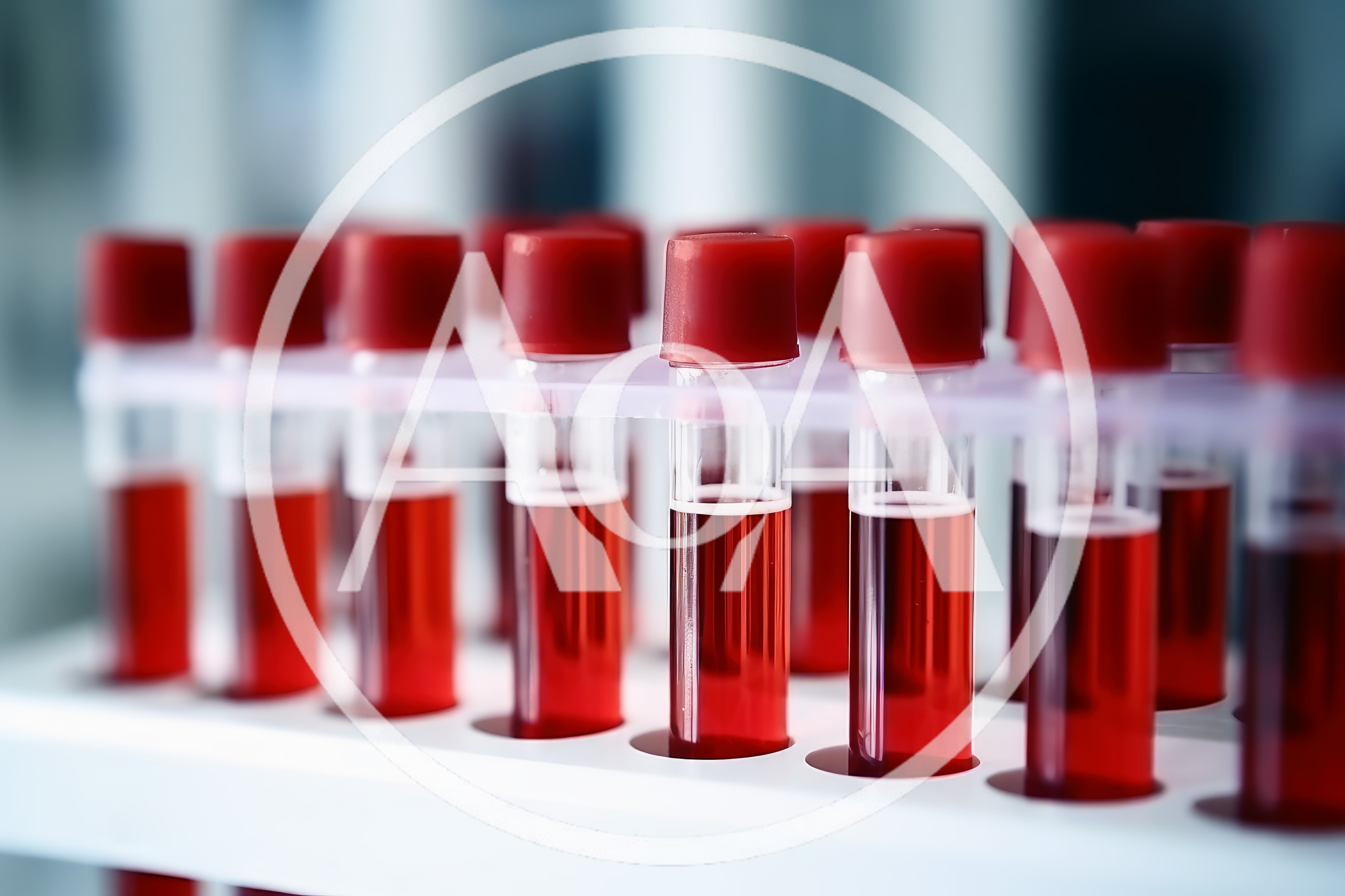 Medical Blood Test Tubes In Laboratory Rack
