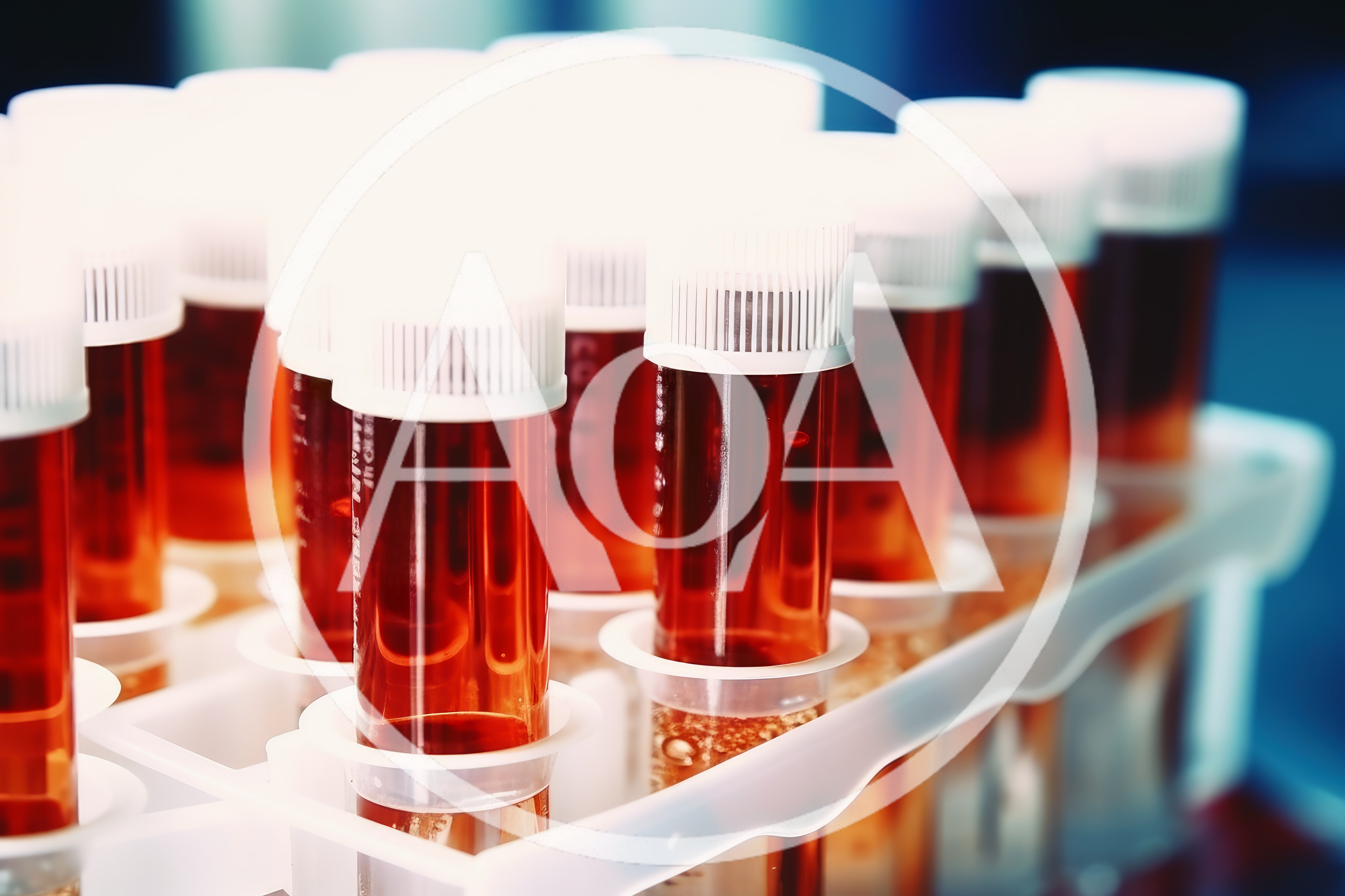 Laboratory Test Tubes Filled With Red Liquid Samples
