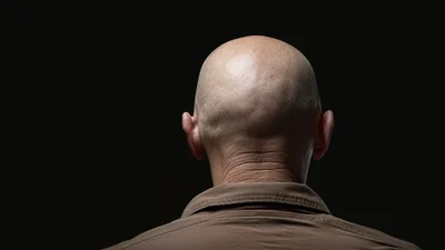 Back View Of A Bald Man In A Brown Shirt