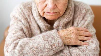 Elderly Woman With Age Spots Resting Her Hand