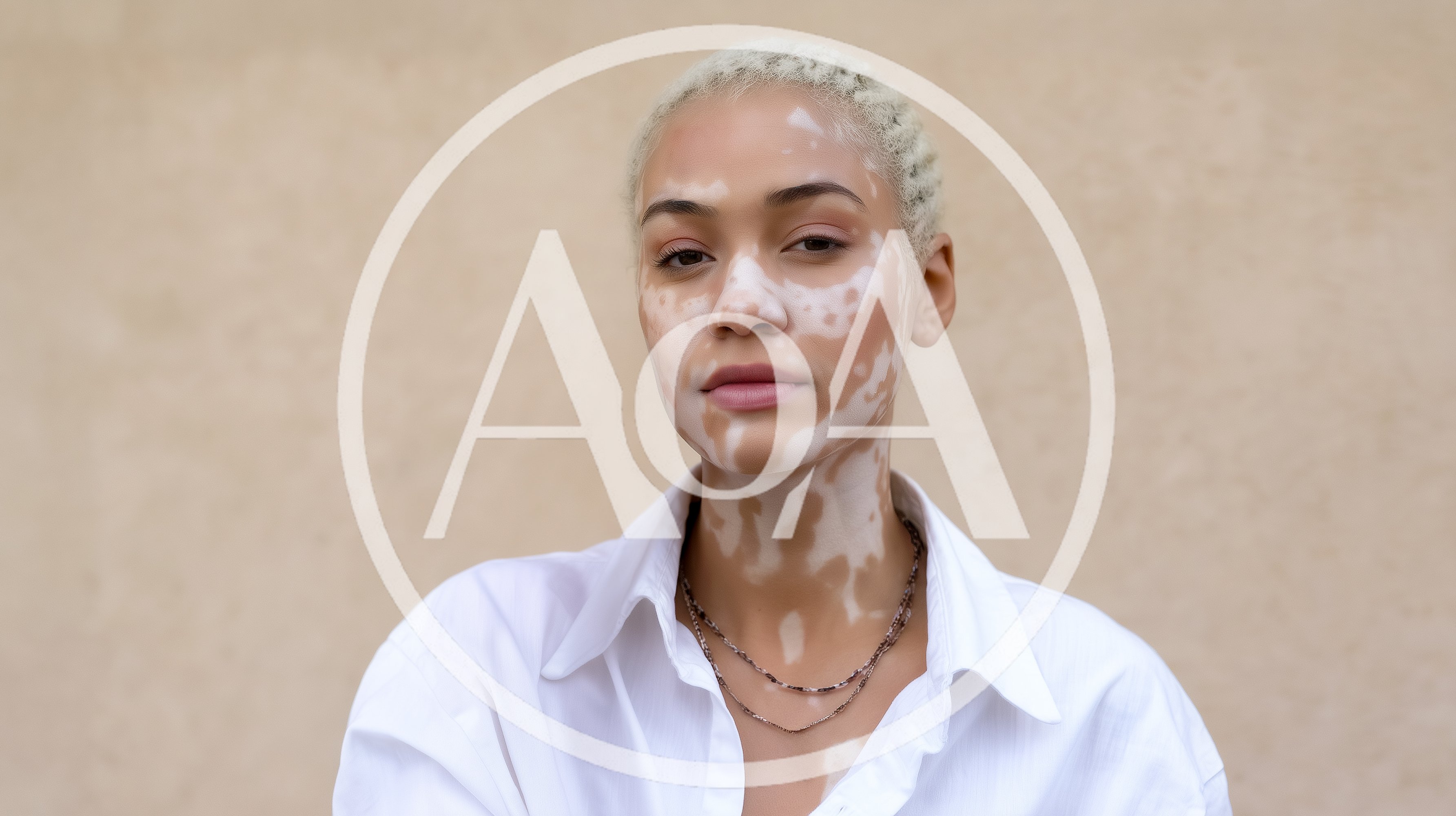 Portrait Of A Young Woman With Vitiligo