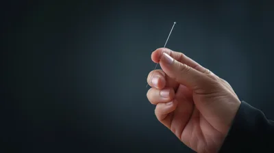Hand Holding A Thin Acupuncture Needle
