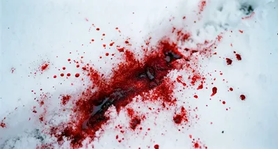 Blood Splatter On Fresh White Snow