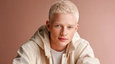 Portrait Of A Young Man With Albinism