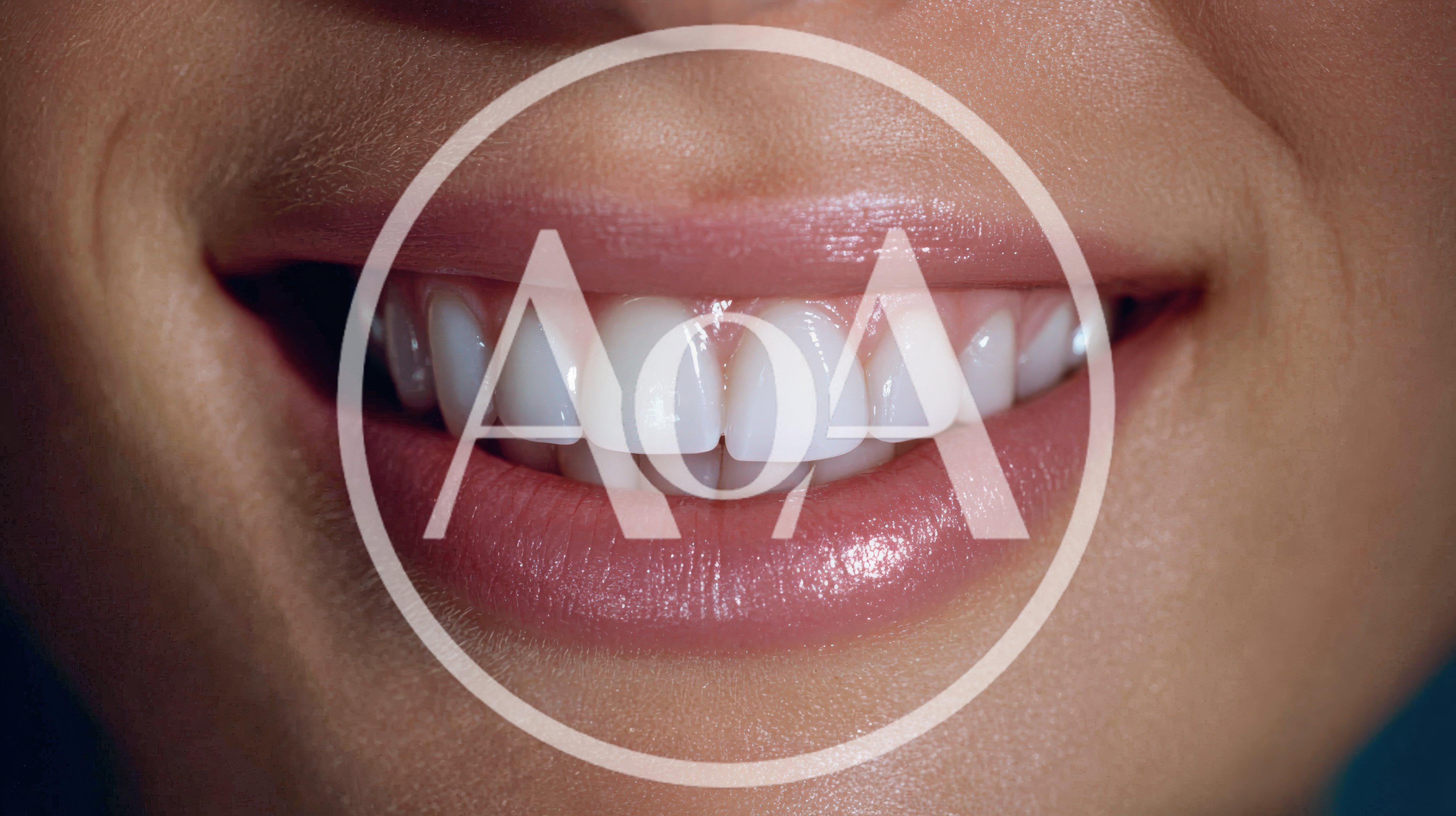 Close Up Of A Woman Smiling With White Teeth